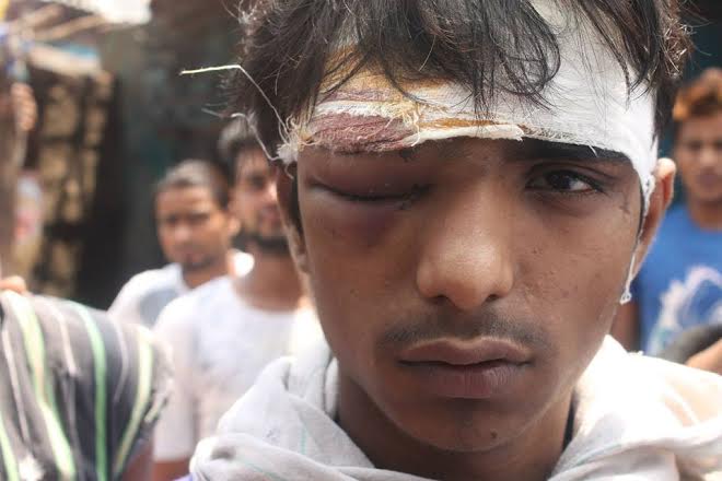 In Delhi, police breaks bones and homes