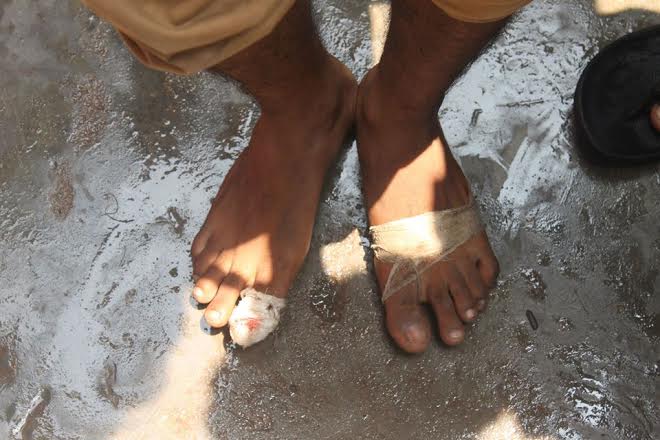 In Delhi, police breaks bones and homes