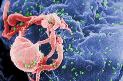 Cancer-fighting gene immunotherapy shows promise as treatment for HIV