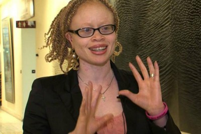 In Malawi, people with albinism face â€˜total extinctionâ€™â€“ UN rights expert   