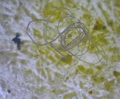 Toronto: Microplastics found in supermarket fish, shellfish