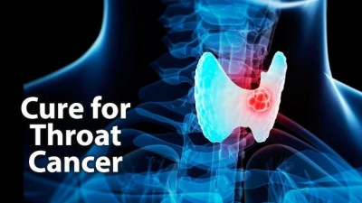 Risk for developing HPV-related throat cancer low, finds study