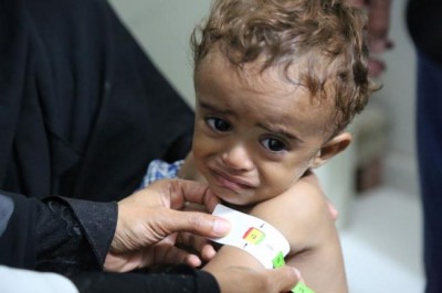  Yemen: UN, partners seek $2.1 billion to stave off famine in 2017