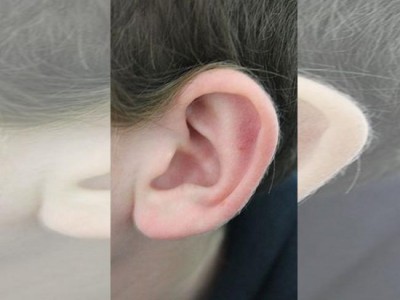 Hearing-related problems common among preschool teachers: Study