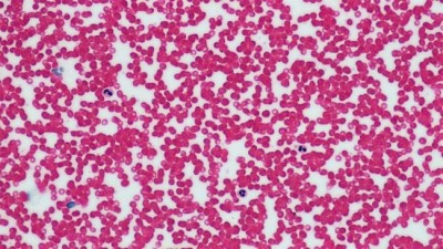 Gut enzymes could hold key to producing universal blood: Study