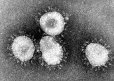 Cow urine, cow dung can treat deadly coronavirus: Assam BJP MLA