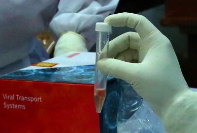 Assam sets target to conduct 2 lakh tests for Covid-19 by Jun 15