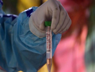 Jammu and Kashmir: Cases expected to rise with increase in daily tests