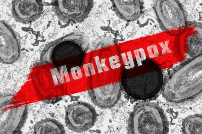 Reason for death of suspected Monkeypox case will be examined: Veena George