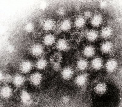 Norovirus outbreak on Caribbean Princess sickens over 100 in cruise horror